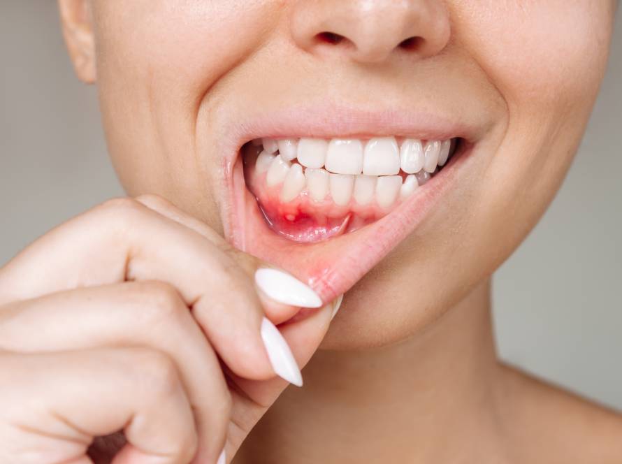 Can Gum Disease Kill You