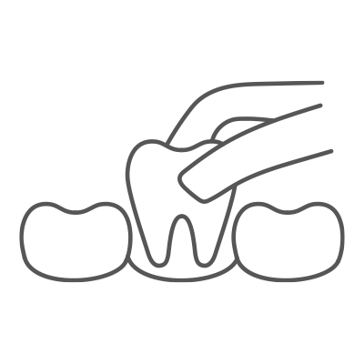 Extraction of teeth