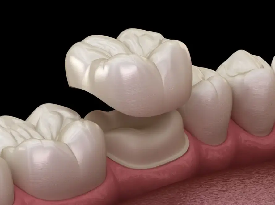 Restorative Dentistry