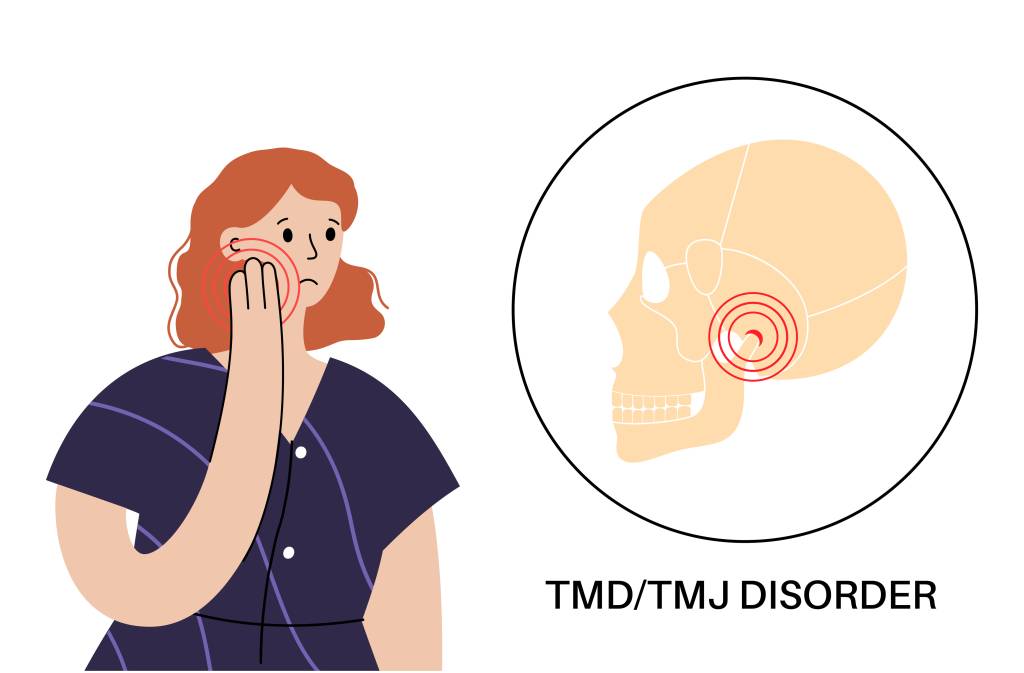 TMD TMJ disorder