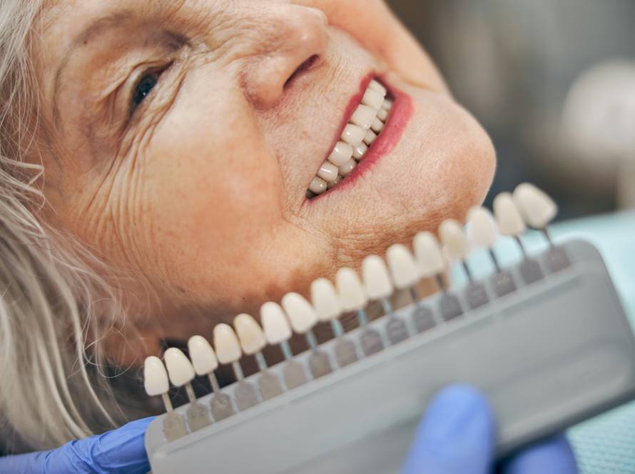 Veneers