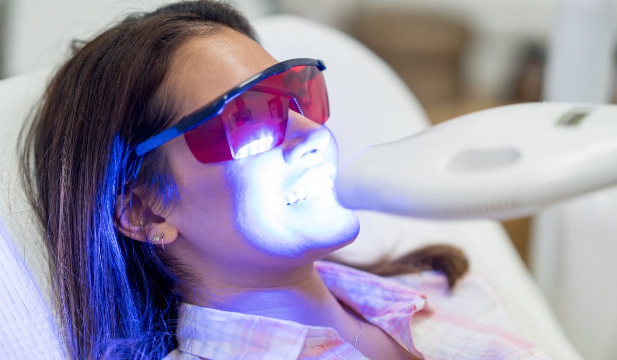 Is Teeth Whitening Permananet