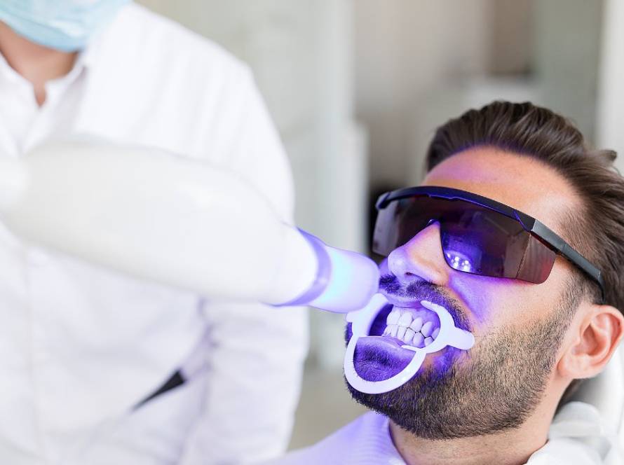 Is Teeth Whitening Permananet