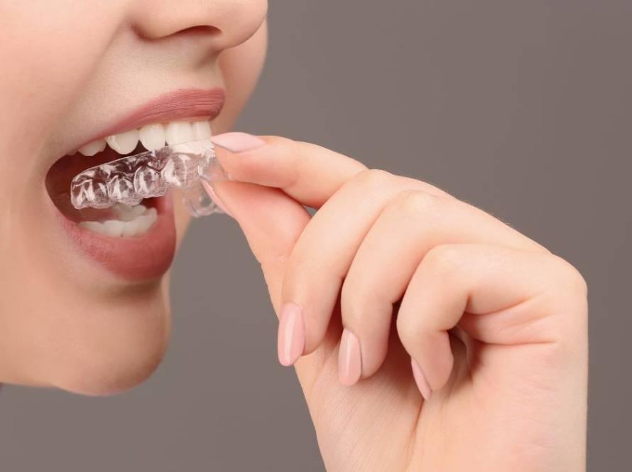 What Is TMJ Splint Therapy