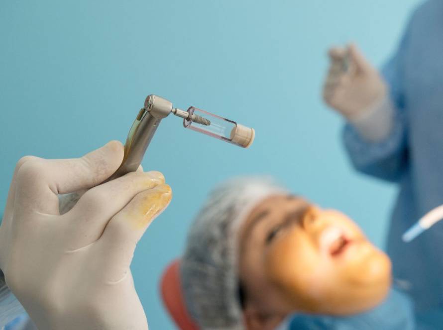Do Dental Implants Hurt